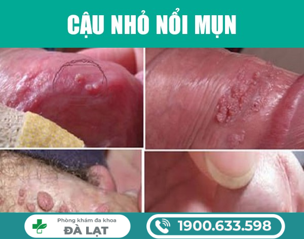 Hình ảnh minh họa